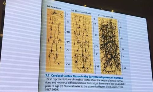 著名教育学家洪兰 激活孩子的大脑发育有3种方式,都很简单