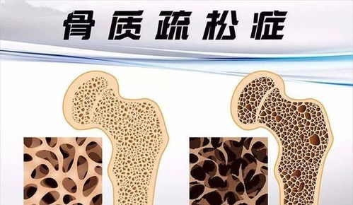 退休之后,常做以下这 3件 事,或对你有益