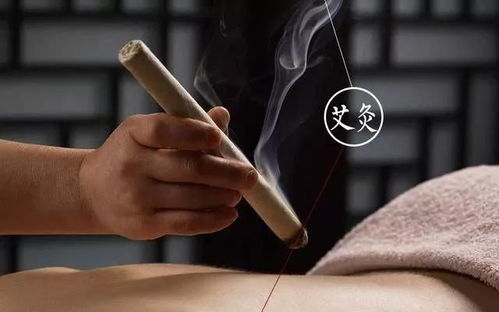 艾灸高手都熟知的8个故事,你知道几个