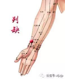 20种病症的针灸取穴及操作手法精华总结