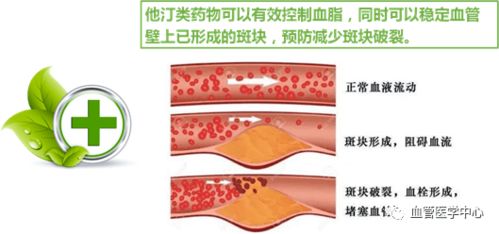 服用他汀类药物应该注意什么呢