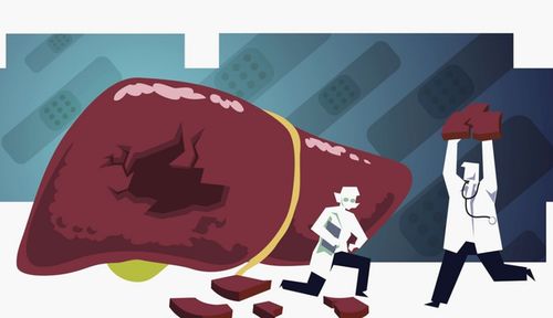肝病多是 吃 出来的 3种食物或比酒还伤肝,劝你少往餐桌上端