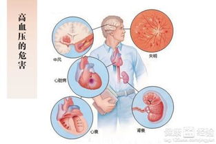 高血压头晕用药更要谨慎