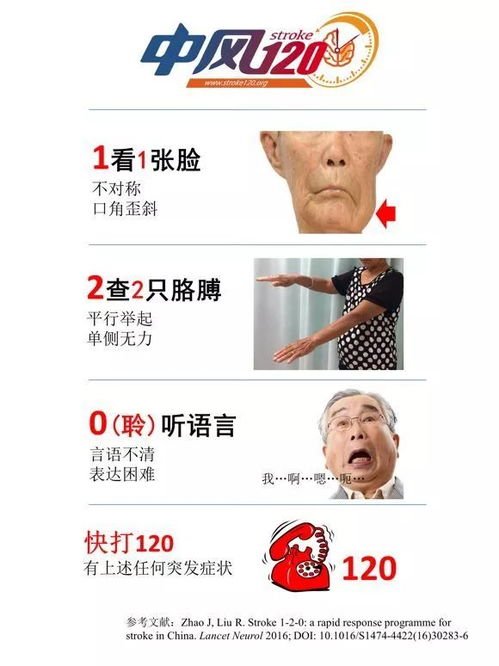 致死率极高 仙游县总医院专家告诫,这三步口诀要牢记