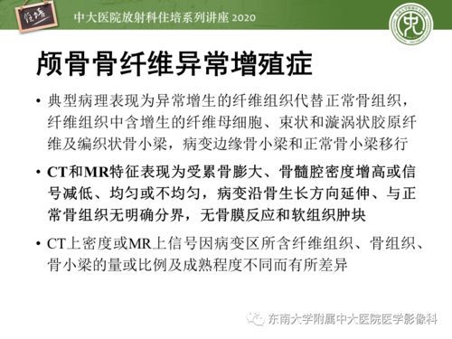 非常详细的颅骨病变总结,务必收藏