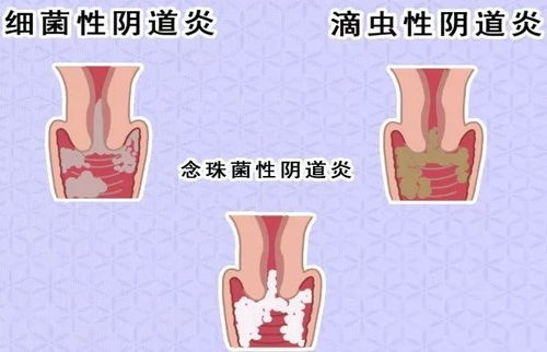 区妇幼所做客 健康有道 特别节目一说说 难言之隐