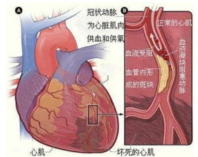 关注 72岁澳籍男子胸痛就诊不治身亡,急诊医生的这个反思必看