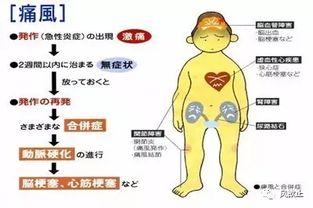 担心副作用 这些方法或可自然改善痛风症状