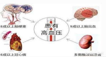 高血压可以根治吗 我为您解答 