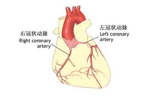 冠状动脉窃血现象 搜狗百科 