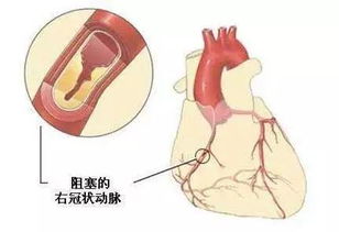 神奇 按一按,竟然能对付人类健康的 第一杀手