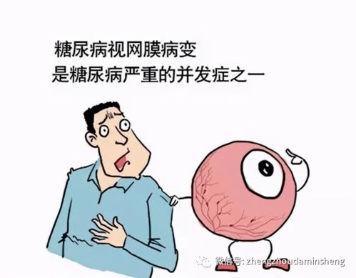 郑说健康 第二十五期 糖尿病视网膜病变 不可忽视的致盲因素