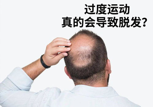 揭秘 健身和脱发有何关联