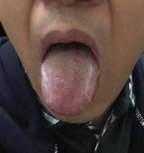 气血水神之调神主方 癫狂梦醒汤 温胆汤