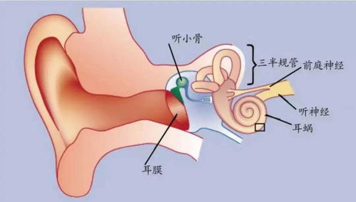 只闻其声不解其意 耳鸣 切莫忽视听神经瘤的可能