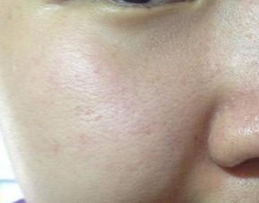 身体有这9种特征的人再不活血化瘀就晚了