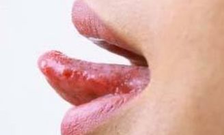 舌头的秘密 医生教你从舌头断疾病,从舌苔看健康