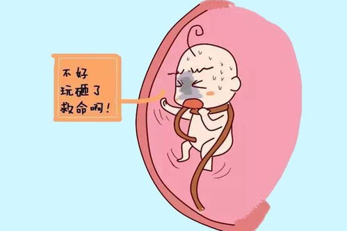 宝宝脐带绕颈后,妈妈会有什么感觉