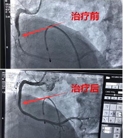 一条微信让78岁的老大爷重获新生