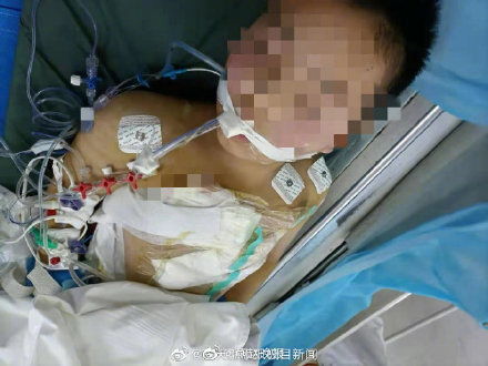 湖南医生9岁儿子遭患者砍杀50多刀,凶手曾在现场围观