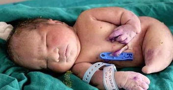 印度女性生无腿宝宝,活15分钟