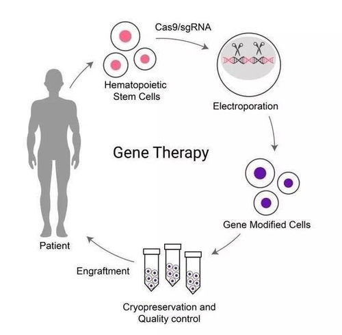 邦耀生物公布基因治疗地中海贫血的多中心临床研究初步数据