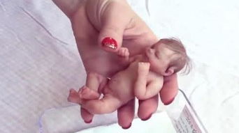 日本庆世界上最小的男婴平安出院 出生时仅268克(世界上最小的沙漠 日本)