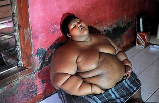 近400斤的 世界最胖小孩 减肥成功,如今他这样了
