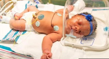 惊人的巧合!9月11日,美国女婴9时11分出生,重9磅11盎(世界上惊人的巧合照片)