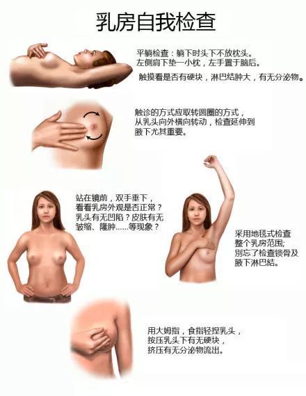 乳腺结节是怎么回事