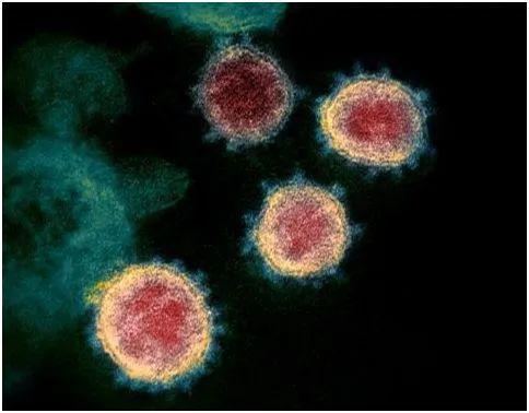 我国科学家发表两篇论文,从粪便中分离出活的新冠病毒,并且在隔离房间的物体表面上检测到新冠病毒RNA