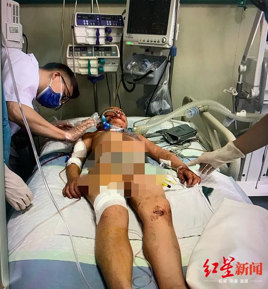 贵州8岁女童被砍伤四肢瘫痪 继父行凶后曾自杀未遂