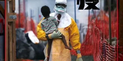 刚果(金)卫生部长隆贡多表示,新一轮埃博拉疫情爆发!揭示埃博(刚果金卫生部电话)