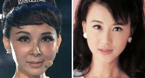 5位整容失败的女星,第2位堪比毁容,最后一位直接成大妈