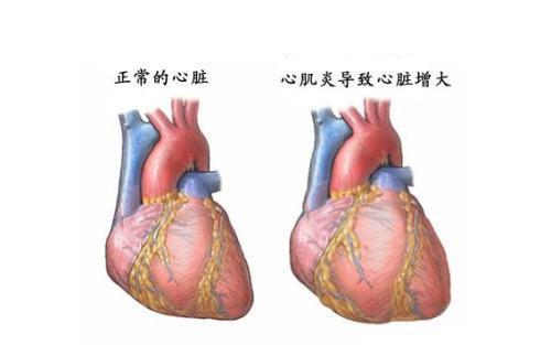 23岁女子心脏停跳,还发朋友圈 多亏优秀医疗团队EMCO救了她命