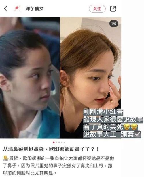 欧阳娜娜这角度疑似整型 网友评论 鼻子真的有变化