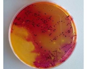 美国多州爆发沙门氏菌感染事件,三大检测要点分析