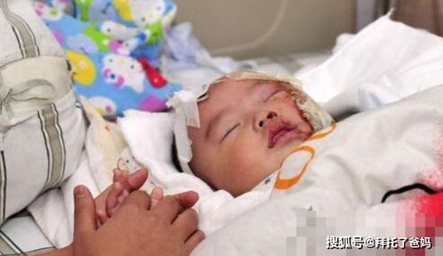 5名宝宝脑出血送往医院,医院检查吓坏了,很多父母都做过