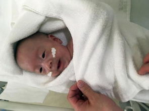 只有巴掌大小的活人 日本诞生仅重258克全世界最小婴儿 