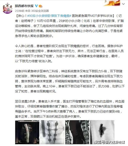 揪心 90后小伙做俯卧撑致下身瘫痪 医院紧急展开MDT多学科诊治