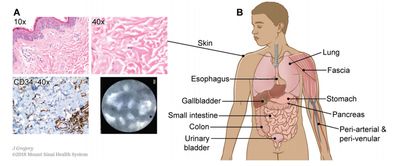 论文:唾液腺:具有放射治疗风险的潜在新器官(哺乳动物具三对唾液腺)