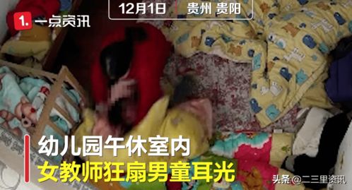 气愤 2岁男童遭老师狂扇耳光致头部骨折