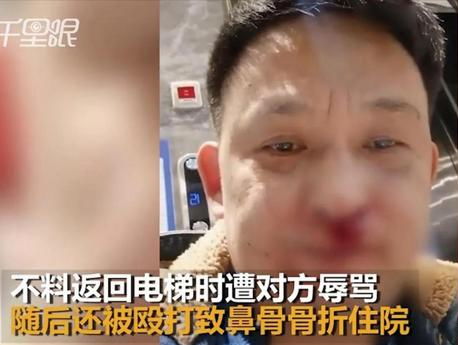 男子好心出电梯让路反被打骨折 如何评价