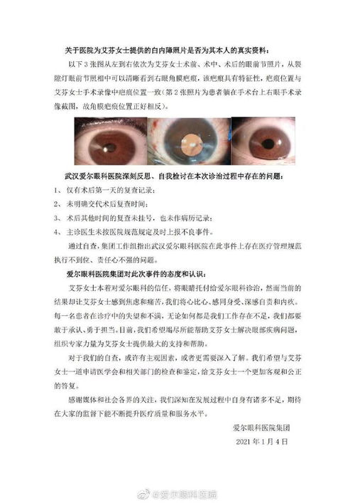 爱尔眼科自查报告 艾芬医生视网膜脱落与白内障手术无直接关联