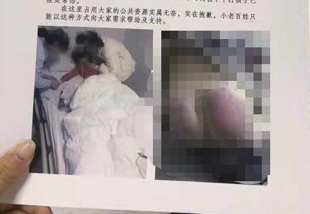 重庆一6岁女童因未完成作业被老师打伤住院,涉事教师称孩子没使劲哭以为不疼