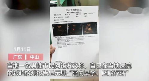 男子肚痛就医,却查出 宫内早孕,胚胎存活