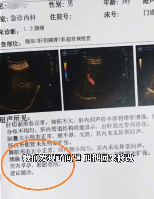 男人怀孕 男子腹痛查B超检出宫内胚胎存活,他慌了,连忙向医院确认