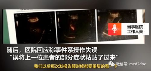 活久见 男子腹痛查B超检出宫内胚胎存活,真相令人哭笑不得