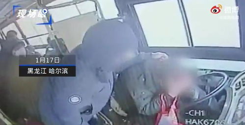 公交司机遭乘客疯狂锤头缝20针 司机 他家人说他有精神病