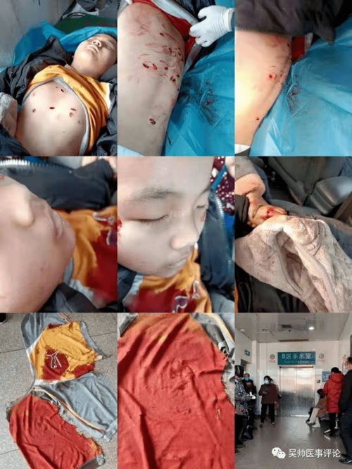 愤怒 湖南医生9岁儿子被患者砍杀50多刀